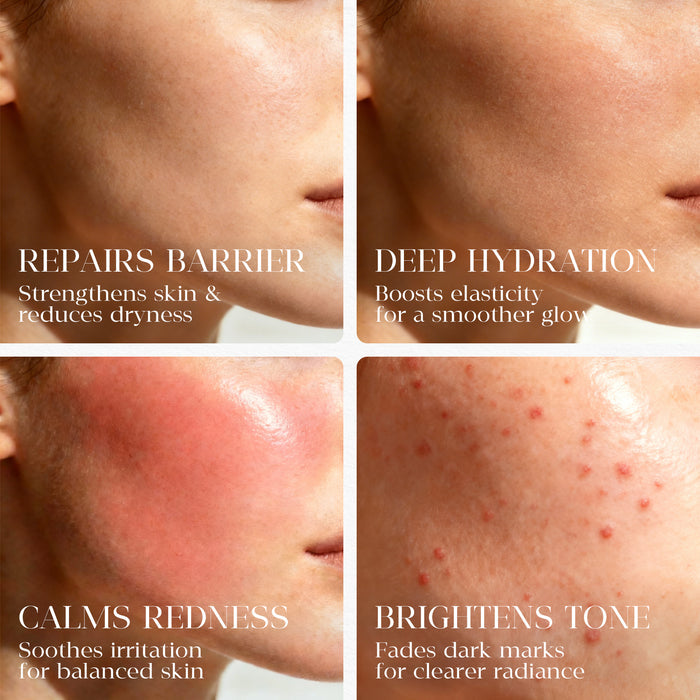 Borage Skin Rescue Oil—— The "Liquid Bandage": Restore Your Barrier & Soothe Redness Instantly.